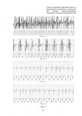 Способ выявления нарушений ритма и проводимости сердца у пациентов с эпилепсией при помощи имплантированного подкожного петлевого регистратора экг (патент 2665019)
