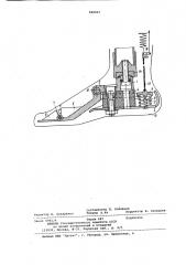 Искусственная стопа (патент 848023)