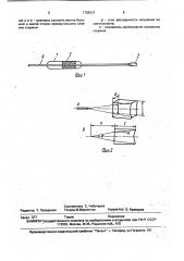 Устройство для лазерного транссклерального облучения передней камеры глаза (патент 1708331)