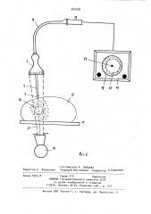 Троакар (патент 942730)