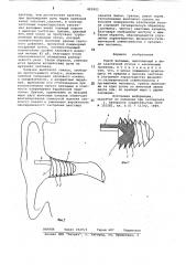 Ушной вкладыш (патент 822821)