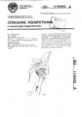 Способ хирургического лечения дисфункциональных синдромов и вывихов суставного диска височно-нижнечелюстного сустава (патент 1146006)