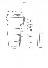 Устройство для остеосинтеза надмыщелковой части голени (патент 982680)
