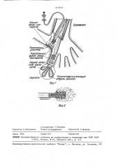 Способ лечения больных с гнойным эндобронхитом (патент 1477412)