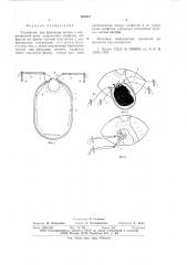 Устройство для фиксации органа в операционной ране (патент 639541)