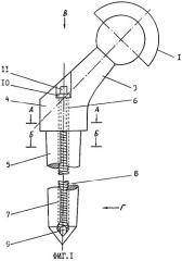 Эндопротез тазобедренного сустава (патент 2255711)