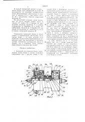 Коленный узел протеза бедра (патент 1428370)