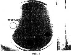 Применение матриксной металлопротеиназы-10 (ммр-10) для тромболитической терапии (патент 2489163)