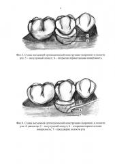 Способ лечения рецессии десны (патент 2649138)