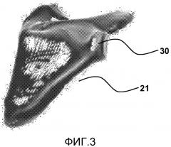 Устройство эндопротезирования плечевого сустава (патент 2569531)