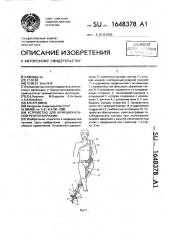 Устройство для функциональной рентгенографии (патент 1648378)