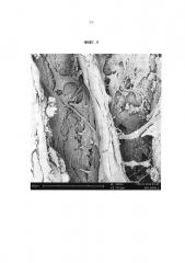 Биомиметический коллаген-гидроксиапатитный композитный материал (патент 2662326)