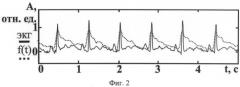 Способ дистанционного контроля параметров сердечной деятельности организма (патент 2559940)