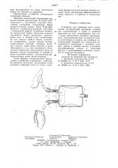 Устройство для отведения мочи (патент 976977)