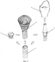 Устройство для формирования десневого канала зубного протеза (патент 2318467)