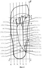 Способ определения локализации нормальных анатомических образований стопы (патент 2315563)