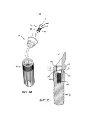 Набор зубных компонентов (патент 2596057)