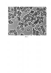 Способ микроскопической оценки цитотоксичности компонентов материалов скаффолдов (патент 2653476)