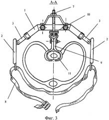 Устройство для лечения воронкообразной деформации грудной клетки (патент 2485903)