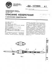 Эндопротез коленного сустава (патент 1572605)