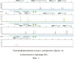 Способ пренатальной и постнатальной днк-диагностики синдрома дауна, эдвардса, патау, мутации delf508 в гене муковисцидоза и резус-фактора плода (патент 2539778)