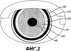 Контактная линза с эффектом ореола (патент 2563495)