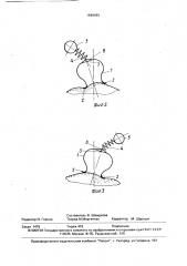 Массажное вакуумное устройство (патент 1648464)