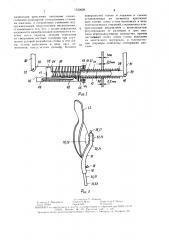 Устройство для лечения переломов лодыжек (патент 1532029)