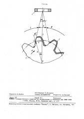 Способ поверхностной термообработки изделий (патент 1541281)