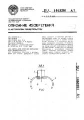Шина для лечения врожденного вывиха бедра (патент 1463281)
