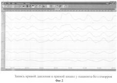 Способ ранней диагностики геморроя (патент 2341187)