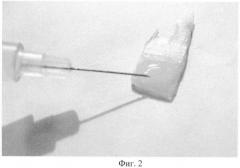 Способ лазерной сварки биологических тканей (патент 2425700)