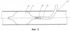 Эластичная оболочка (патент 2499944)