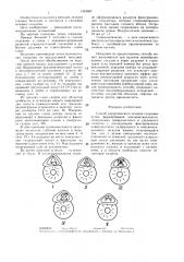 Способ хирургического лечения глаукомы (патент 1419697)