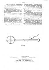 Устройство для внутрисердечной дефибрилляции (патент 1220673)
