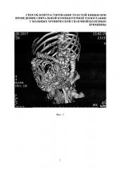 Способ контрастирования толстой кишки при проведении спиральной компьютерной томографии у больных хронической спаечной болезнью брюшины (патент 2666120)