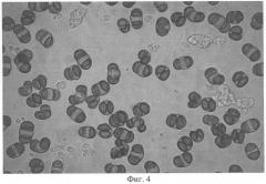 Микроноситель для культивирования субстратзависимых клеток животных in vitro (патент 2328527)