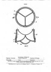 Биопротез аортального клапана сердца (патент 1806696)