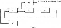 Способ исследования кинестетической чувствительности и система для его осуществления (патент 2529382)