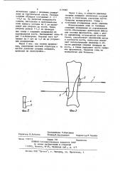 Устройство для фиксации костных фрагментов (патент 1179982)