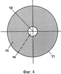 Способ хирургической коррекции пресбиопии в сочетании со сферической гиперметропией (патент 2306912)