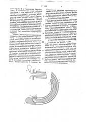 Устройство для биопсии (патент 1771708)