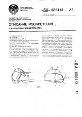 Протез верхней конечности (патент 1553113)