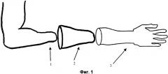 Система управления протезом от культи (патент 2419399)