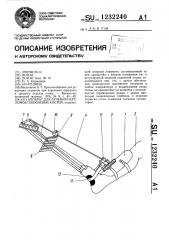 Аппарат для лечения переломов плюсневых костей (патент 1232240)