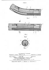 Уретероскоп (патент 1106475)