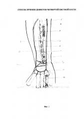 Способ лечения дефектов четвертой пястной кости (патент 2610534)