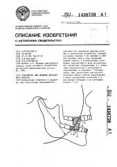 Устройство для лечения дистального прикуса (патент 1438759)