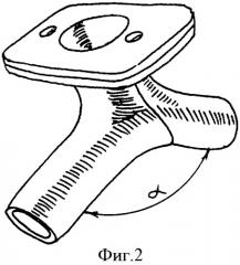 Трахеотомическая трубка для стентирования подголосового отдела гортани (патент 2341213)