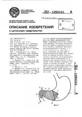 Способ гастродуоденоанастомоза при язвах двенадцатиперстной кишки (патент 1098545)